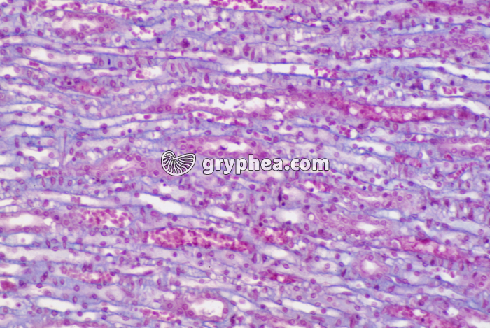 Rein zone médullaire x40 - gryphea.com